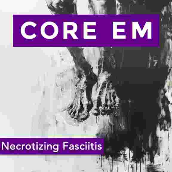 https://coreem.net/content/uploads/2025/01/Necrotizing-Fasciitis.001-1.jpeg