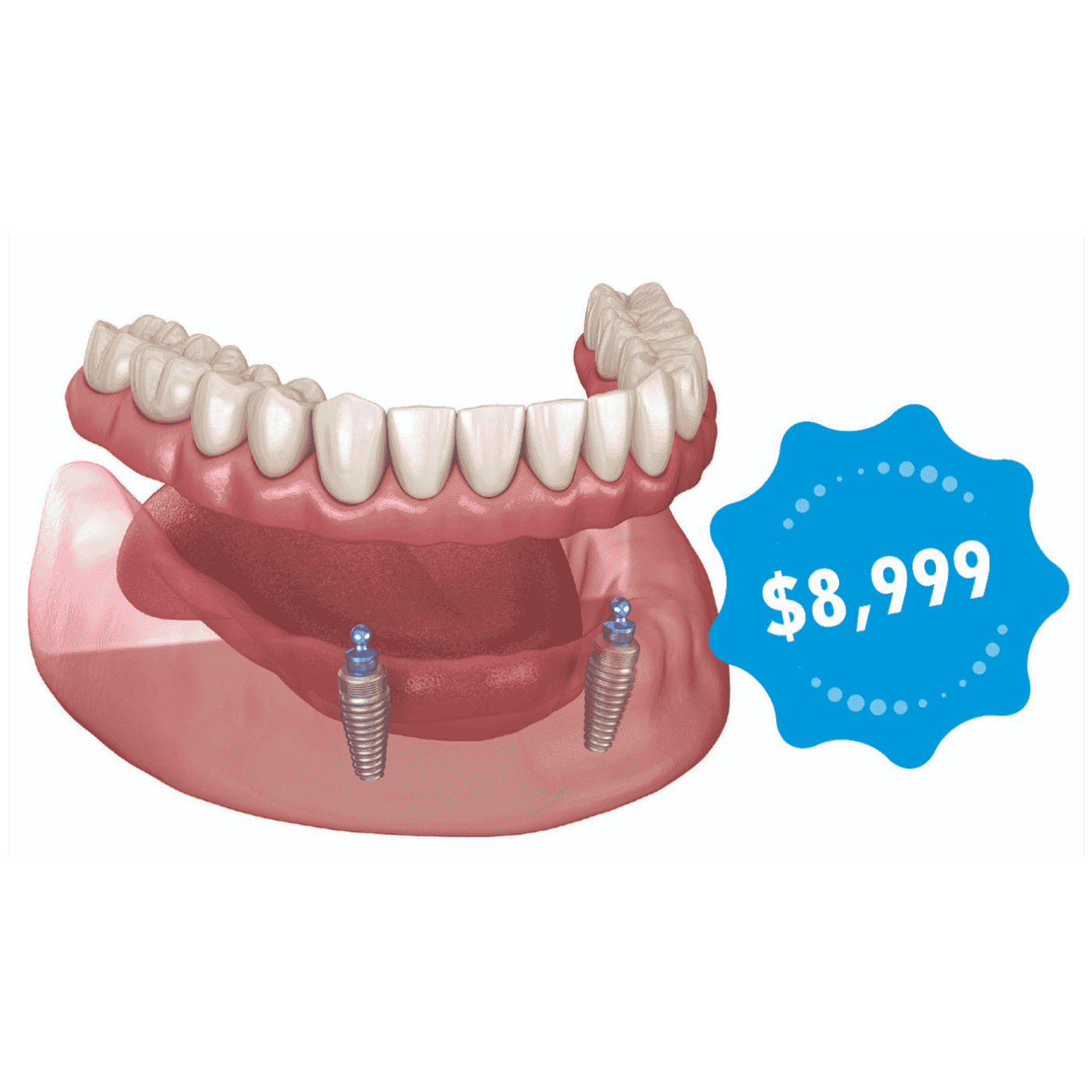 https://media.rss.com/modern-dental-solution-the-future-is-here/ep_cover_20241106_111134_00ed02a543aee6bb008fc3857a43b5f2.png
